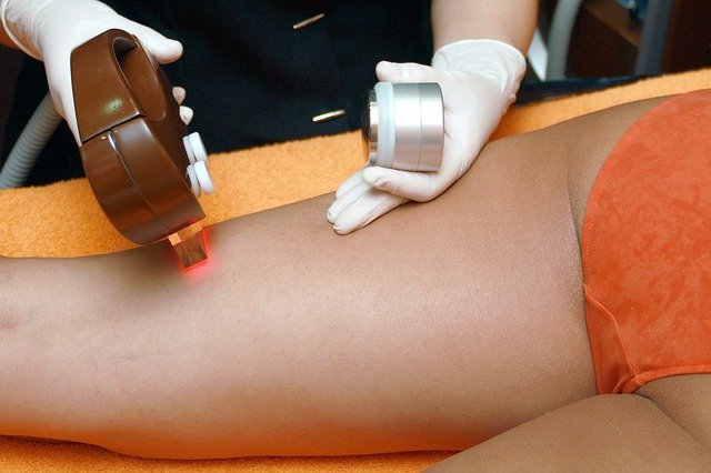 Should I Go For Laser Hair Removal?